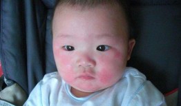 小孩吃蒲瓜过敏吗,过敏风险知多少？